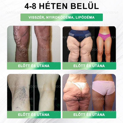 🎁 DOOEKA® GLP-1 8 az 1-ben Fit & Vital Szájon át szedhető oldat – 👨‍⚕️ Napi egyszer, 7 nap alatt látható változás / Elhízás, szív- és érrendszeri egészség, cukorbetegség, alvási apnoe, bélrendszer egészsége, ízületi problémák és még sok más esetén🎁